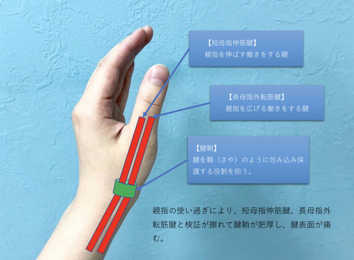 腱鞘炎　ケア　腱鞘③